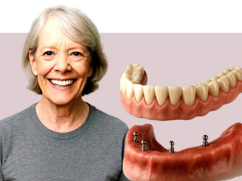 fogimplantátum akció